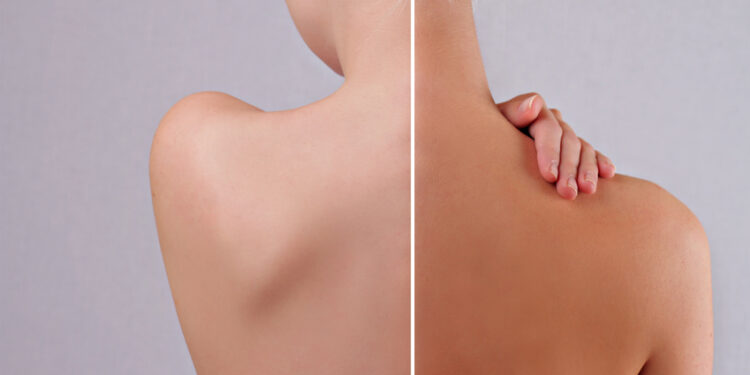 Comment enlever l autobronzant