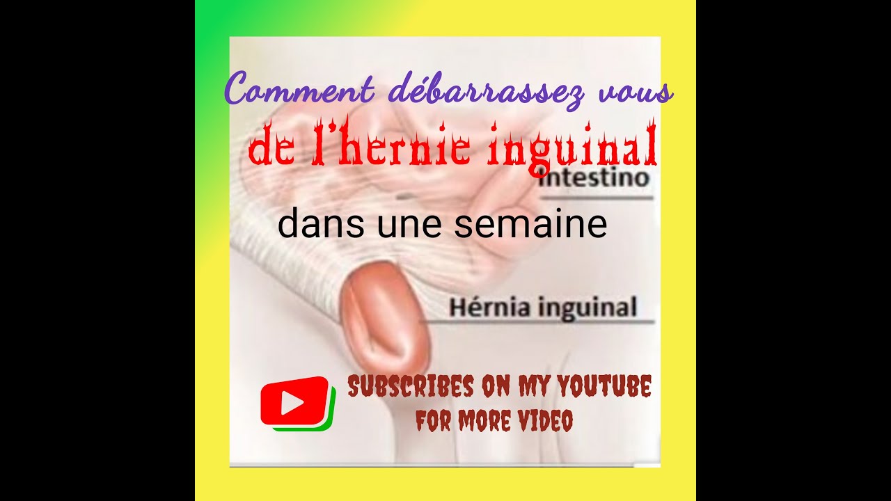 Comment Soigner Une Hernie Abdominale Sans Chirurgie Planetefemmes Magazine D Informations