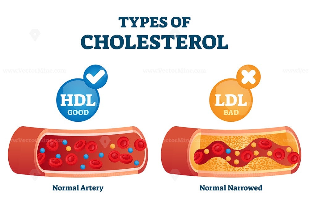 type-of-cholesterol-medizzy